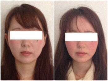 美容整体ウェリナ あま甚目寺院/小顔矯正/骨盤矯正/美脚サロン