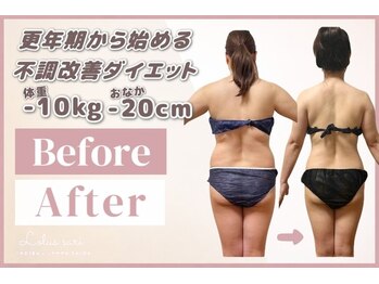 ロータスサリの写真/徒歩30秒★大人女性の為の<リンパのお掃除専門サロン>更年期から始まった体の不調を根本改善!リンパ節開け