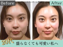 グレースフィオーレ 南越谷店(gracefiore)