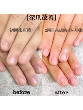 プライズアイリス アイラッシュ 池袋東口店(prize Iris eyelash)/深爪改善【池袋】