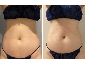 ルナグランデ(Luna grande.)/お腹周りもスッキリ!