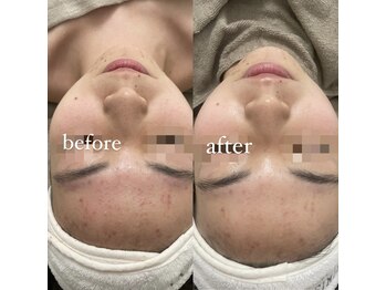 サーデ(saade)/クリスティーナ アンストレス