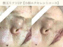 エミルカ 仙台(EMILUCA)の雰囲気（もやっとシミ/シワ/たるみにお悩みの方に◎より若々しい印象に♪）