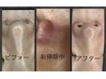 お鼻☆毛穴集中ケア黒ずみエクストラクション/水素水使用/50分