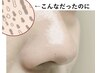 詰まった毛穴を撃退！毛穴ごっそり洗浄　¥11000→4980