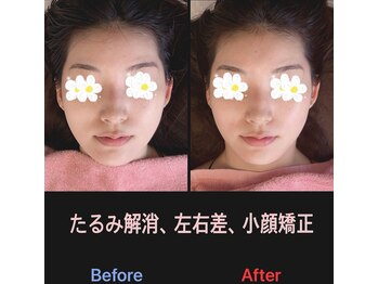 美容矯正サロン レレポノ(LELEPONO)/