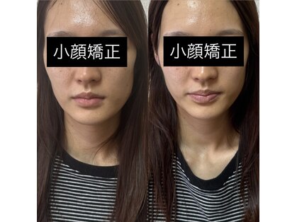 ルピナス 立川店の写真