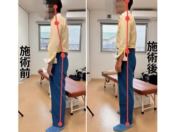 カイロプラクティック ラウレア 豊川店の写真/長引く腰のつらさにサヨナラ！本格「整体」「骨盤矯正」で根本原因にアプローチし、驚くほど軽い身体へ☆