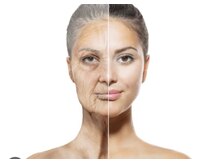 ヨサ パーク コアハート(YOSA PARK CORE HEART)/内側からハリのあるお肌に