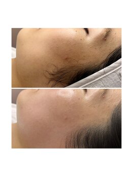 ホワイトワックス 京都四条烏丸(WHITE WAX)/トーンアップ↑