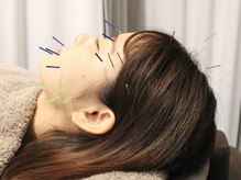 サボ 表参道 原宿(SABO)/悩み解消｜美容鍼×整体SABO