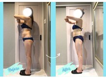 千歳の女神 三河安城店/【施術風景】Before/After