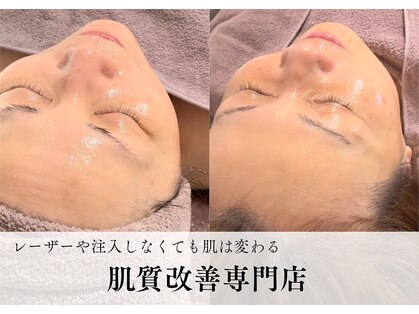 エルナ(ELUNA)の写真