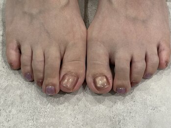 ナッティ(natti)/うるマグ(enoiジェル)