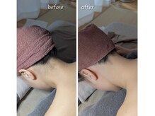 ユーニマルヨン(ewe204)/お剃りする箇所