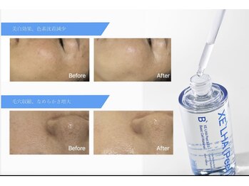 アイラッシュ ネイル ココ(COCO)の写真/「剥く」はもう古い？最新の「育てる」ピーリング。ララピール進化版【セラピール】「水光ツヤ肌」を実感♪