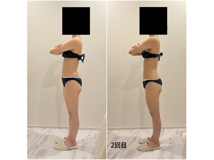 テトテ(TEtoTE)の写真