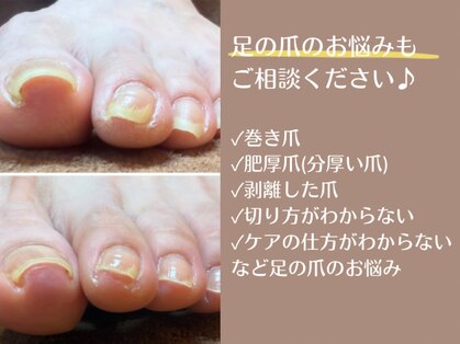 ネイルブルームーン(Nail Blue Moon)の写真
