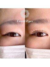 チュラアイズ(CerahEyes)/【お客様ビフォーアフター】