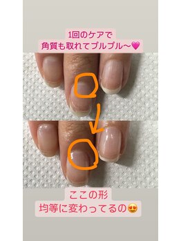 カンパニュラ(Campanula)/自爪育成での変化