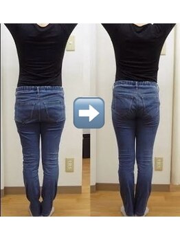 カイロプラクティック ネクサス/産後の骨盤歪み撃退☆