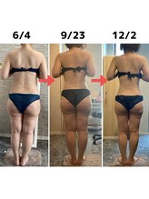 ハレアンド(Hare&)/40代全身痩身6ヶ月Before After