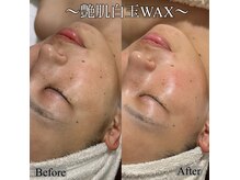 エレガ(ELEGA)の雰囲気（くすみ改善には白玉WAXがオススメです◎翌日からの化粧ノリも◎）