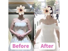 ボディキュア ブライダル美容整体 大阪梅田/【合計ー14kg】花嫁の本気ケア