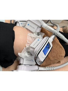 サイズダウンを目指したい