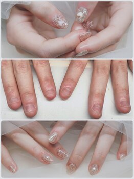 ネイル フライガール(nail FLY GIRL)/爪でお悩みの方／パラジェル