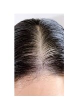 キュライム カブール町田店/薄髪のお悩み改善に導く◎