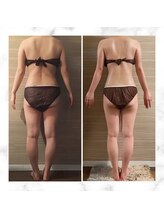 エムズ ビューティー サロン(M's Beauty Salon)/ビフォーアフター