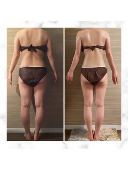 エムズ ビューティー サロン(M's Beauty Salon)/ビフォーアフター