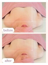 ワム(Wom)/バストケア/下垂ケア/弾力