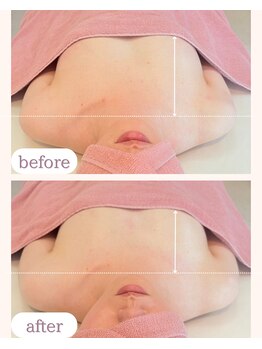 ワム(Wom)/位置が変われば見た目年齢も変化