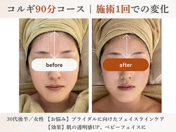 エルマ(elma)/コルギ90分before&after