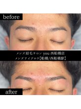 ユー 西船橋店(you)/ビフォーアフター写真