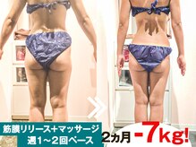 お悩みやご要望、体に合わせた最適な施術をご提案いたします。