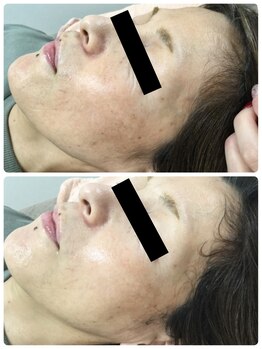 メイユール(MEILLEUR)/