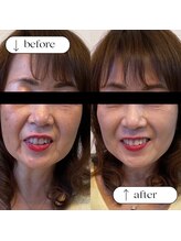 トータルビューティーサロンリア(Li'a)/ビフォー＆アフター