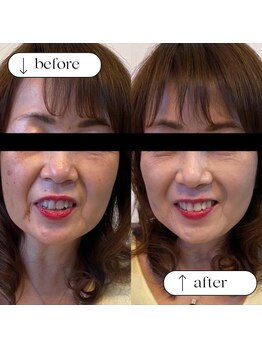 トータルビューティーサロンリア(Li'a)/ビフォー＆アフター