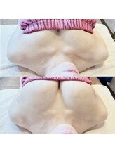 ロココ 北千住店(Rococo)/