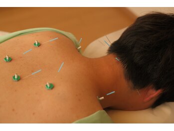 メイロン(meilong)/お灸