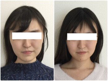 美容整体ウェリナ 名駅院/小顔矯正/骨盤矯正/美脚サロン