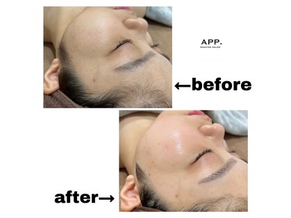 アプ(APP.)の写真