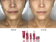 ドクタープラント 北心斎橋店(DR PLANT)/ビフォーアフター