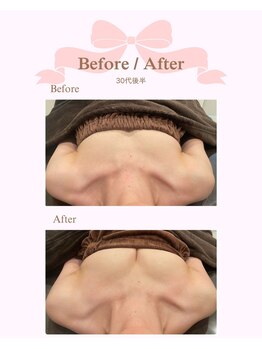 ロココ 安城店(Rococo)/バストアップ症例