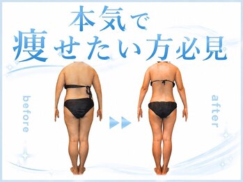 ジュリアン 千葉店(Julien)の写真/脂肪燃焼したい、大幅減量を目指したいという方に◎オーダーメイド施術で理想のボディラインを叶えます！
