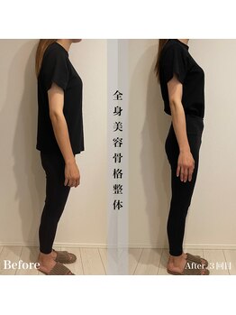 アール アンド ビューティーサロン(Ｒ＆ BeautySalon)/姿勢矯正