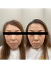 【新感覚な暖かさ】温感ヘッドスパ＋小顔血流首肩デコルテマッサージ